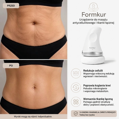 Shape Treatment – masażer przeciwcellulowy na brzuch, nogi i pośladki