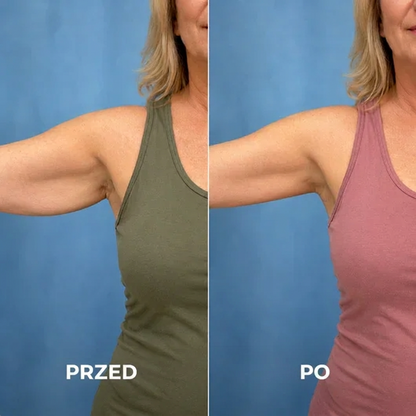 Shape Treatment – masażer przeciwcellulowy na brzuch, nogi i pośladki